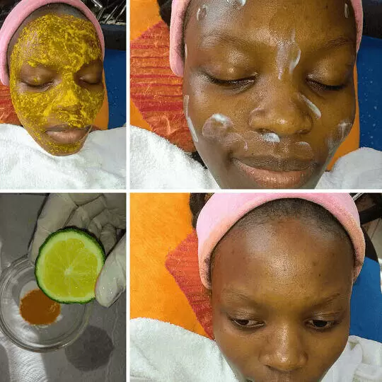 A collage of a face with & without turmeric, baking soda and lemon home-made facial mask