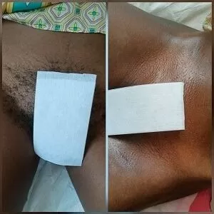 A collage of before and after Brazilian waxing by Viv's in-Houz spa, a mobile waxing service in Nairobi