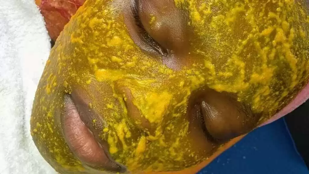 A face covered in turmeric, baking-soda, lemon home-made facial mask