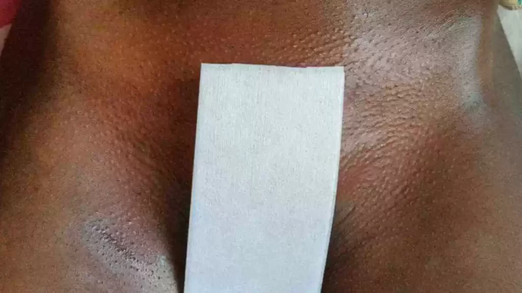 A hairless pubic zone after first time Brazilian waxing